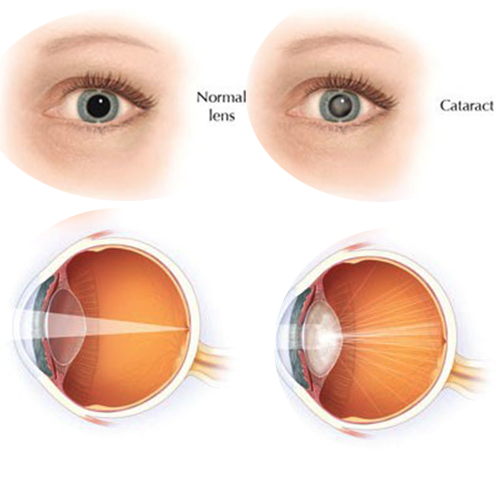 Eye care centre near me,
