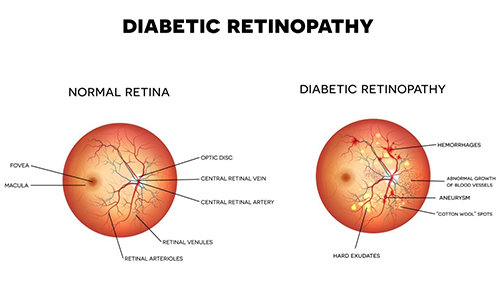 Eye doctor near me,