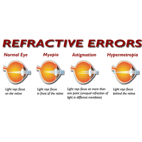 Best eye hospital in Chandigarh,